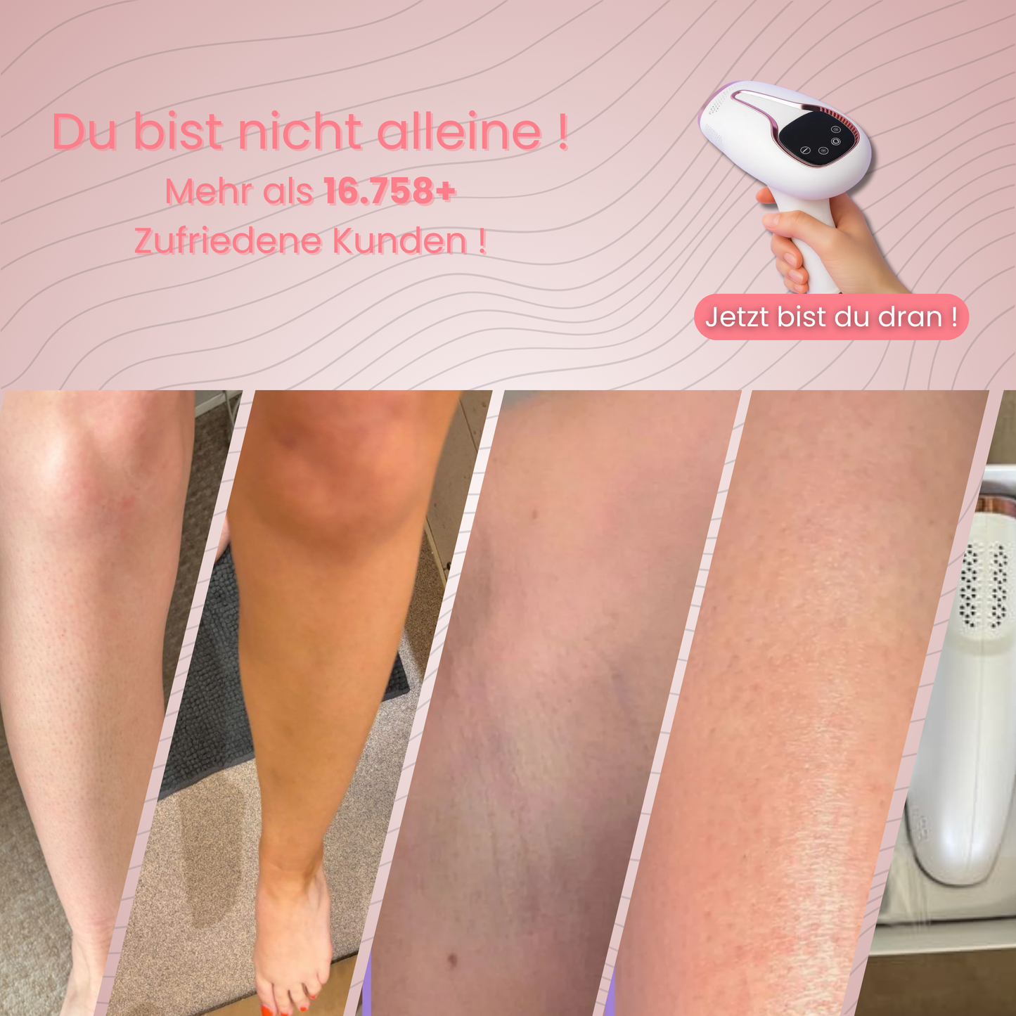 Skinlux - Daloper`s Lasergerät